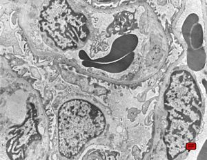 F,49y. | normal kidney F,49y. | normal kidney
